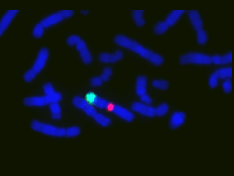 DICOMOSA